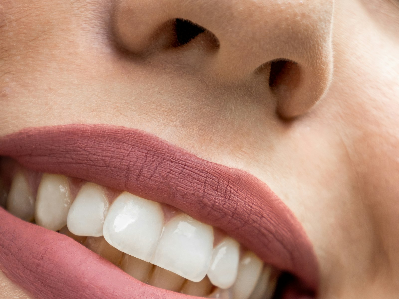 Detalle de una sonrisa después de un blanqueamiento