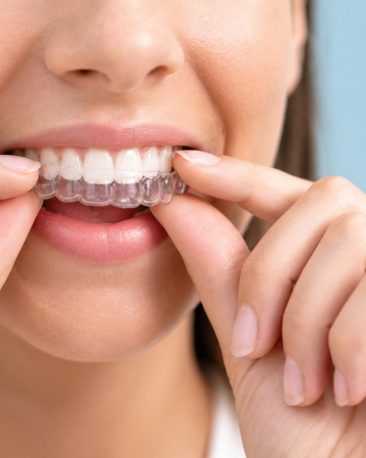 Mujer ajustándose unos alineadores dentales transparentes