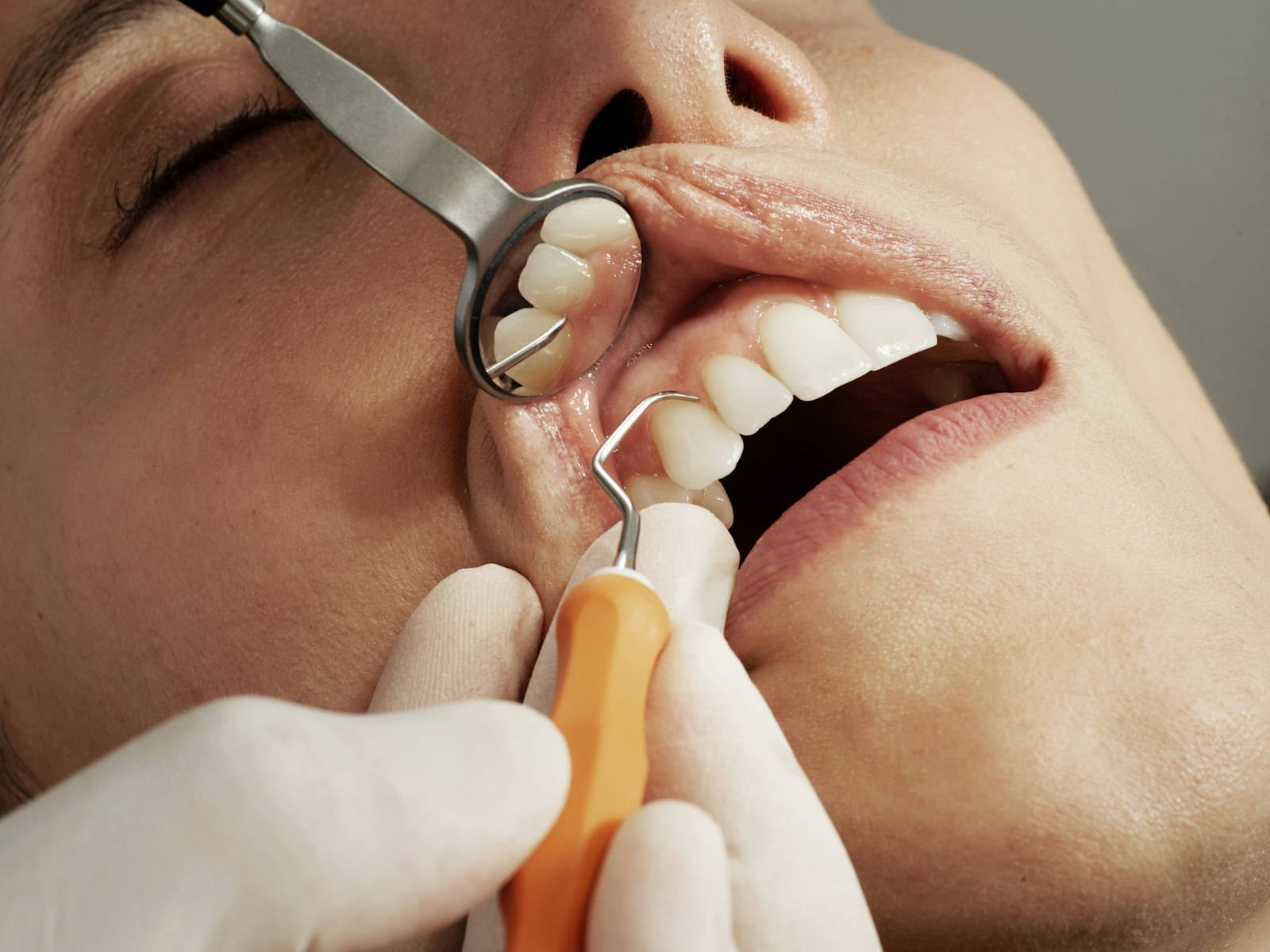 Revisión de encías con espejo y sonda dental