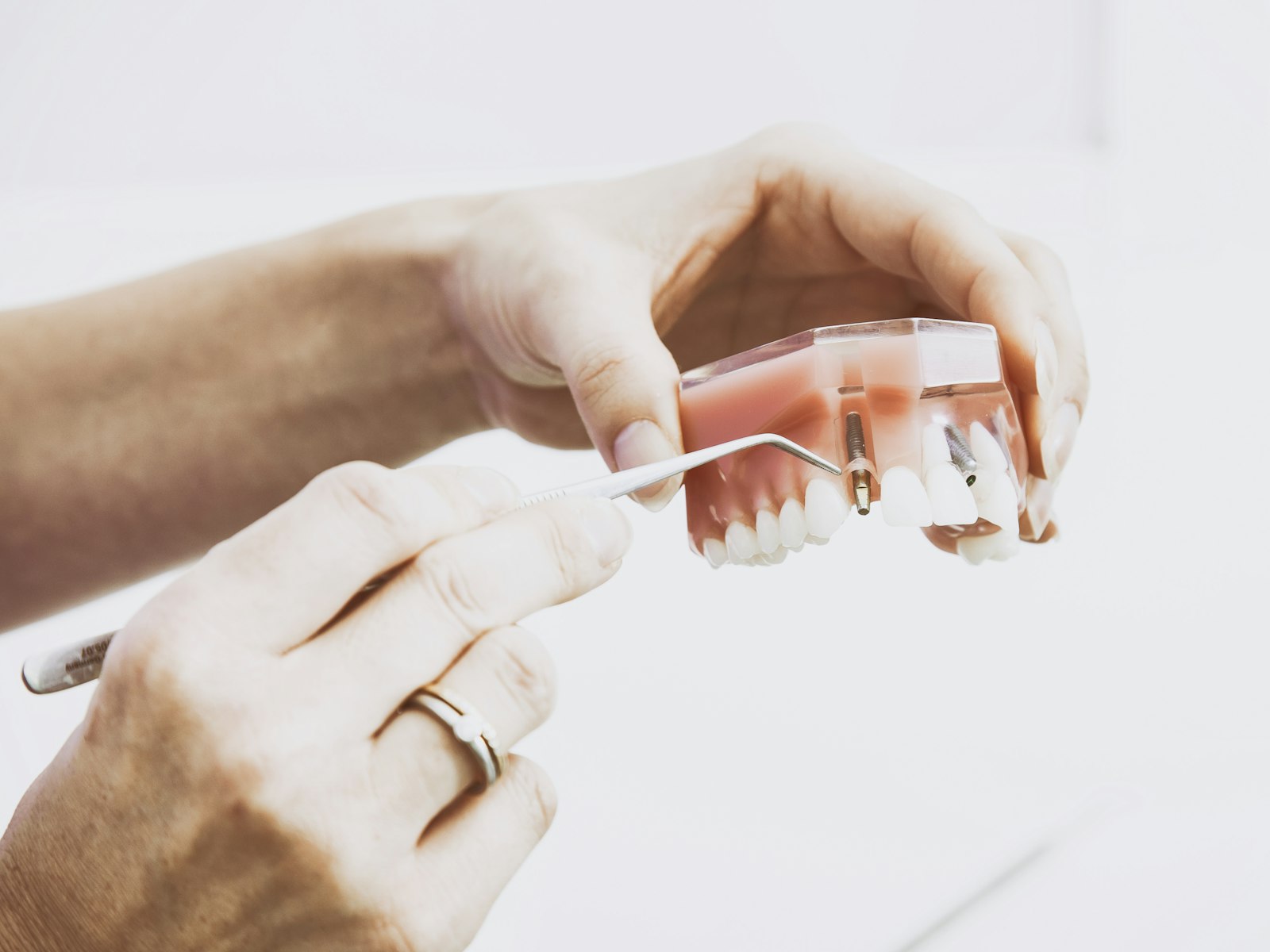 Manos sujetando una prótesis dental completa